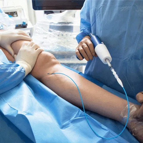 VASCULAR SURGERY