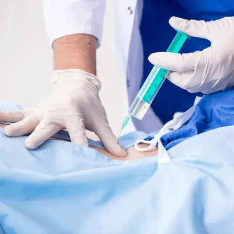 PAINLESS LABOUR
